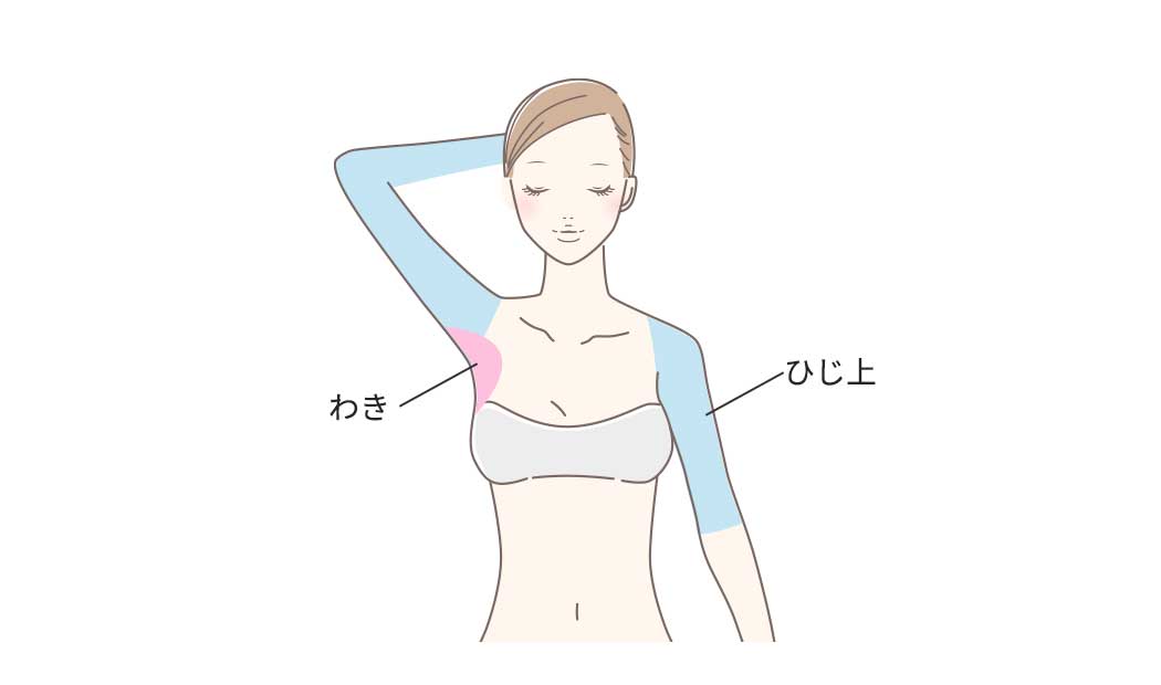 わき・ひじ上の照射部位の図